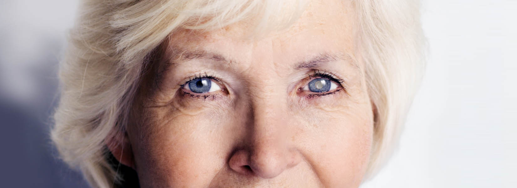 Cataract Surgery in Beavercreek